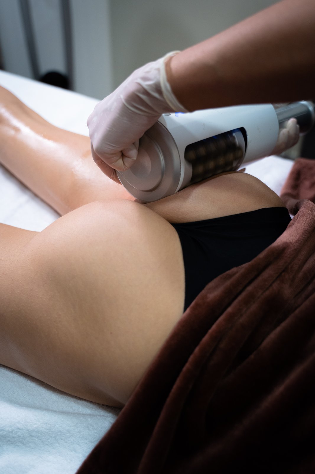 Endospheres therapy galleria